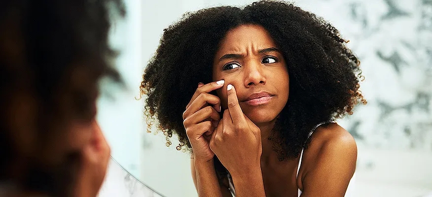 Black woman checking facial acne in mirror with concerned expression
