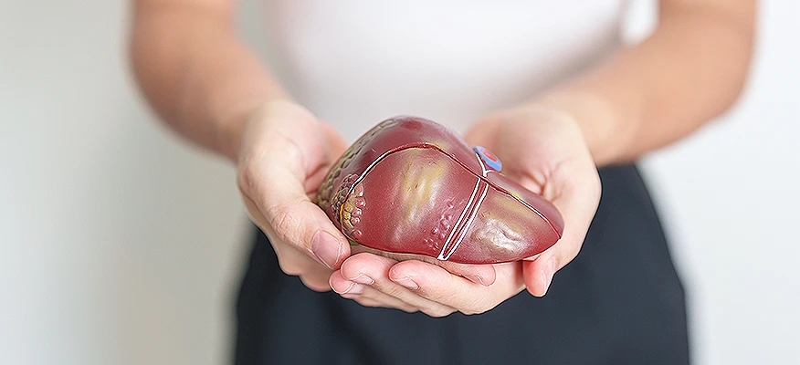 Doctor showing fatty liver