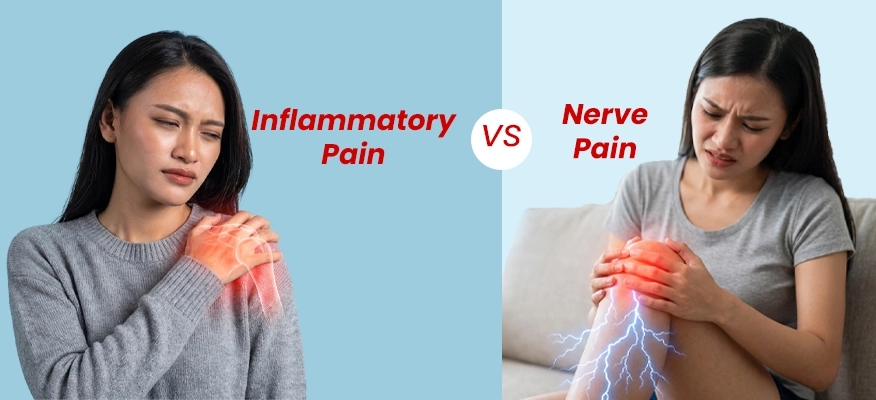 Distinguishing Inflammatory and Nerve Pain
